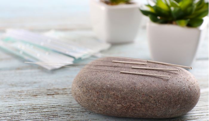 Was ist Rinder-Akupunktur und wie wirkt sie?